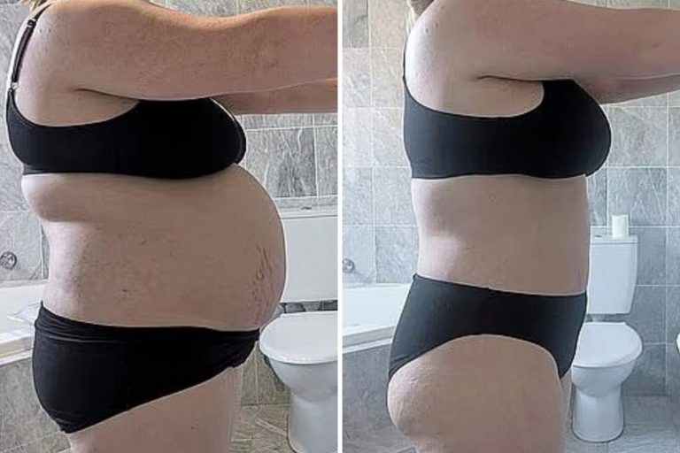 Corrective Care Medical Weight Loss in Claremont, CA