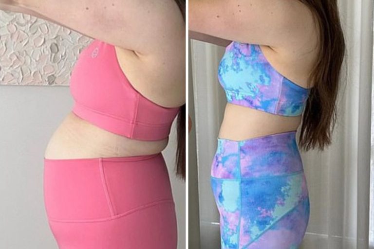 Corrective Care Medical Weight Loss in Claremont, CA